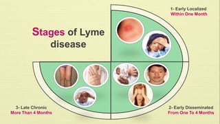 Stages of Lyme 
disease 
1- Early Localized 
Within One Month 
2- Early Disseminated 
From One To 4 Months 
3- Late Chronic 
More Than 4 Months 
 