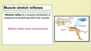 Muscle stretch reflexes 
Stretch reflex is a muscle contraction in 
response to stretching within the muscle. 
Absent ( lower motor neuron lesion) 
 