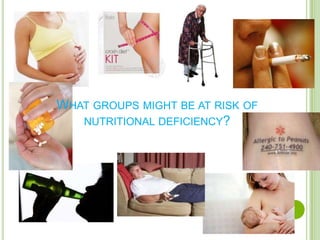 WHAT GROUPS MIGHT BE AT RISK OF
   NUTRITIONAL DEFICIENCY?
 