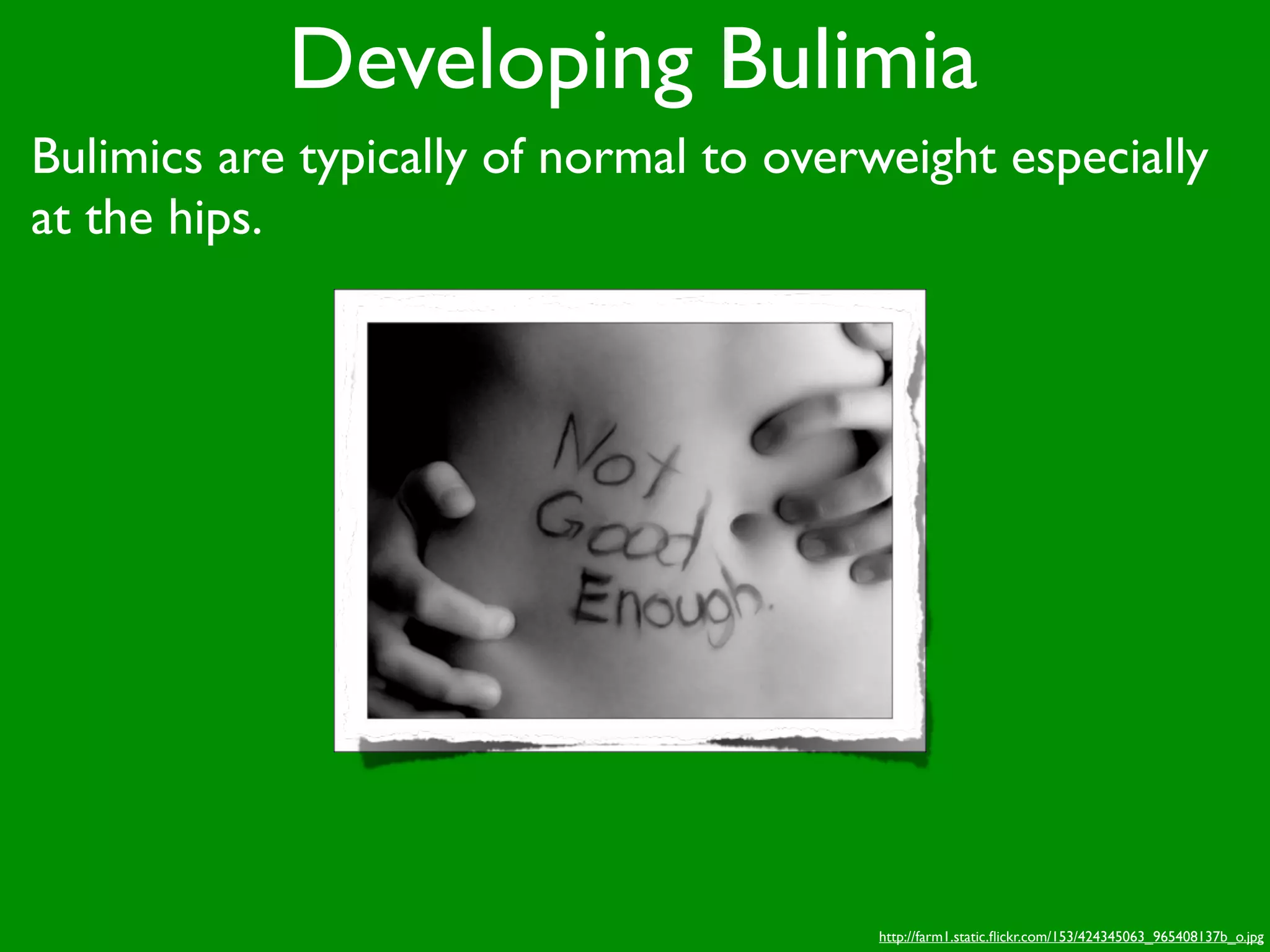 Developing Bulimia
Bulimics are typically of normal to overweight especially
at the hips.




                                         http://farm1.static.ﬂickr.com/153/424345063_965408137b_o.jpg
 