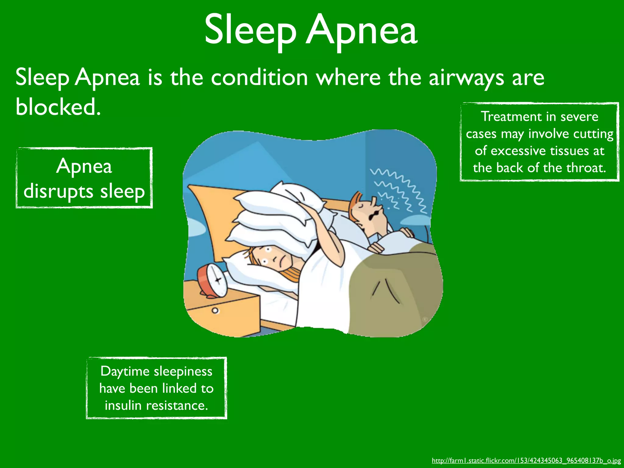 Sleep Apnea
Sleep Apnea is the condition where the airways are
blocked.                                    Treatment in severe
                                                       cases may involve cutting
                                                        of excessive tissues at
    Apnea                                               the back of the throat.
disrupts sleep




         Daytime sleepiness
         have been linked to
          insulin resistance.


                                             http://farm1.static.ﬂickr.com/153/424345063_965408137b_o.jpg
 