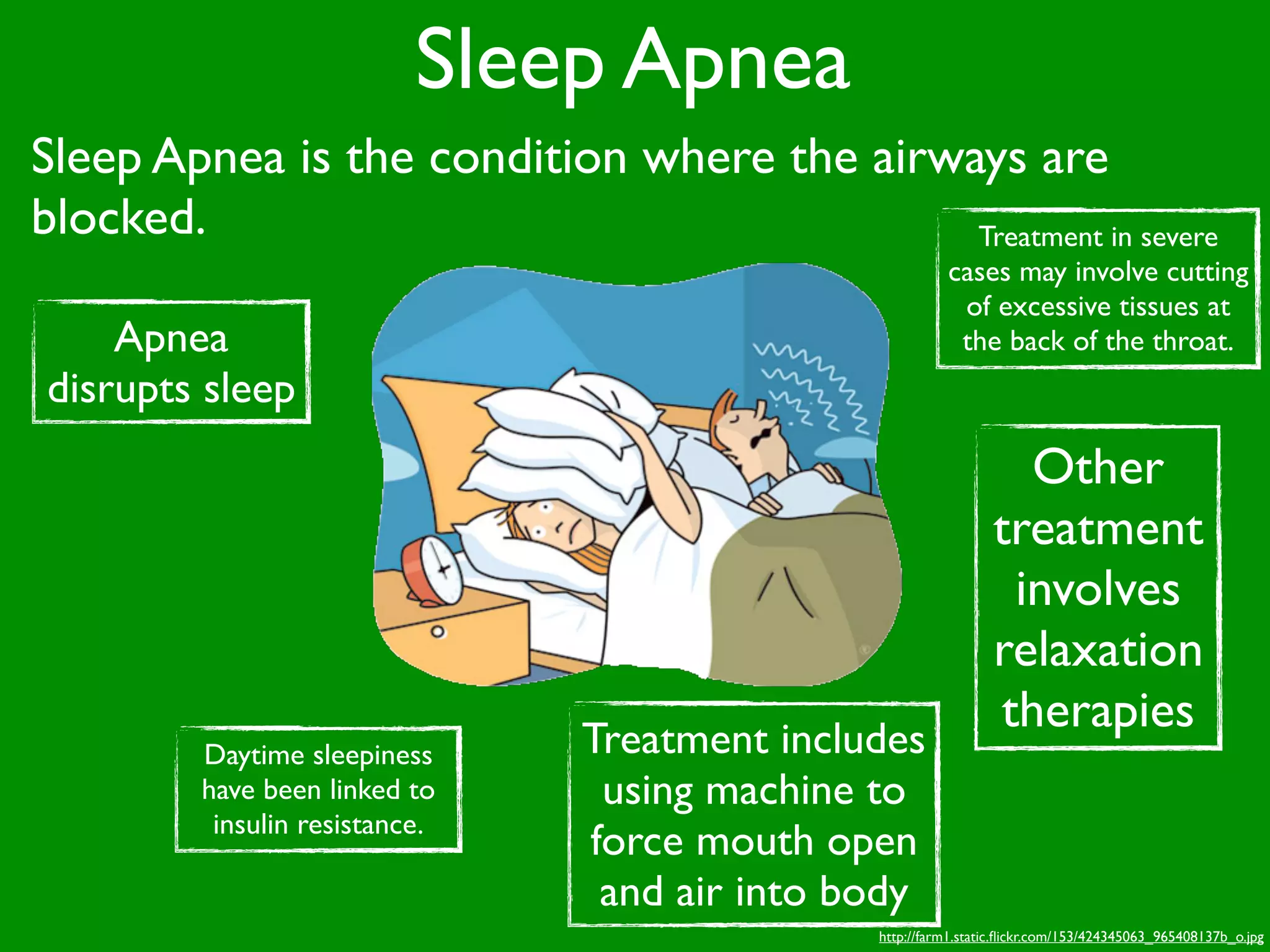 Sleep Apnea
Sleep Apnea is the condition where the airways are
blocked.                                    Treatment in severe
                                                         cases may involve cutting
                                                          of excessive tissues at
    Apnea                                                 the back of the throat.
disrupts sleep
                                                                  Other
                                                                treatment
                                                                 involves
                                                                relaxation
                                                                therapies
         Daytime sleepiness     Treatment includes
         have been linked to     using machine to
          insulin resistance.
                                force mouth open
                                 and air into body
                                               http://farm1.static.ﬂickr.com/153/424345063_965408137b_o.jpg
 