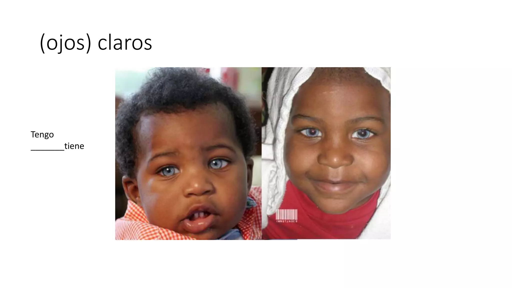 (ojos) claros
Tengo
_______tiene
 