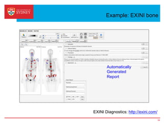 Example: EXINI bone
EXINI Diagnostics: http://exini.com/
54
Automatically
Generated
Report
 