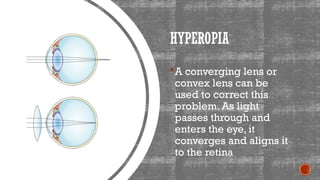 Grade 10 Science - The Human Eye Analysis | PPTX