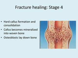 Initial Callus Formation Week7musculoskeletallecture | POTX