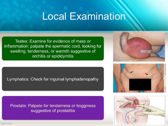 Approach to Urethritis 