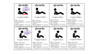 ท่านอยู่ในท่านั่งยืดขา ท่านอยู่ในท่านั่งยืดขา ท่านอยู่ในท่านั่งยืดขา ท่านอยู่ในท่านั่งยืดขา
ผู้บาดเจ็บ ผู้บาดเจ็บ ผู้บาดเจ็บ ผู้บาดเจ็บ
ผู้บาดเจ็บ ผู้บาดเจ็บ ผู้บาดเจ็บผู้บาดเจ็บ
ท่านอยู่ในท่านั่งชั่นเข่า ท่านอยู่ในท่านั่งชั่นเข่า ท่านอยู่ในท่านั่งชั่นเข่า ท่านอยู่ในท่านั่งชั่นเข่า
Eye = 4 ลืมตาได้เอง
Verbal response = 2 ส่งเสียงอือ อา
ไม่เป็นคาพูด
Motor response = 3 ตอบสนองต่อ
การกระตุ้นที่ทาให้เจ็บ โดย แขน ขางอเข้าผิดปกติ
Eye = 4 ลืมตาได้เอง
Verbal response = 2 ส่งเสียงอือ อา
ไม่เป็นคาพูด
Motor response = 3 ตอบสนองต่อ
การกระตุ้นที่ทาให้เจ็บ โดย แขน ขางอเข้าผิดปกติ
Eye = 4 ลืมตาได้เอง
Verbal response = 3 ส่งเสียงพูด
เป็นคาๆ แต่ฟังไม่รู้เรื่อง
Motor response = 3 ตอบสนองต่อ
การกระตุ้นที่ทาให้เจ็บ โดย แขน ขางอเข้าผิดปกติ
Eye = 4 ลืมตาได้เอง
Verbal response = 3 ส่งเสียงพูด
เป็นคาๆ แต่ฟังไม่รู้เรื่อง
Motor response = 3 ตอบสนองต่อ
การกระตุ้นที่ทาให้เจ็บ โดย แขน ขางอเข้าผิดปกติ
Eye = 4 ลืมตาได้เอง
Verbal response = 4 พูดเป็นคาๆ
แต่ไม่ถูกต้องกับเหตุการณ์
Motor response = 3 ตอบสนองต่อ
การกระตุ้นที่ทาให้เจ็บ โดย แขน ขางอเข้าผิดปกติ
Eye = 4 ลืมตาได้เอง
Verbal response = 4 พูดเป็นคาๆ
แต่ไม่ถูกต้องกับเหตุการณ์
Motor response = 3 ตอบสนองต่อ
การกระตุ้นที่ทาให้เจ็บ โดย แขน ขางอเข้าผิดปกติ
Eye = 4 ลืมตาได้เอง
Verbal response = 4 พูดเป็นคาๆ
แต่ไม่ถูกต้องกับเหตุการณ์
Motor response = 3 ตอบสนองต่อ
การกระตุ้นที่ทาให้เจ็บ โดย แขน ขางอเข้าผิดปกติ
Eye = 4 ลืมตาได้เอง
Verbal response = 4 พูดเป็นคาๆ
แต่ไม่ถูกต้องกับเหตุการณ์
Motor response = 3 ตอบสนองต่อ
การกระตุ้นที่ทาให้เจ็บ โดย แขน ขางอเข้าผิดปกติ
ส่ง
เสียง
โวยวา
ย
ส่ง
เสียง
โวยวา
ย
 