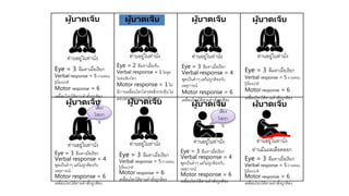 ท่านอยู่ในท่านั่ง ท่านอยู่ในท่านั่ง
ผู้บาดเจ็บ ผู้บาดเจ็บ ผู้บาดเจ็บ ผู้บาดเจ็บ
Eye = 3 ลืมตาเมื่อเรียก
Verbal response = 5 ถามตอบ
รู้เรื่องปกติ
Motor response = 6
เคลื่อนไหวได้ตามคาสั่งถูกต้อง
Eye = 2 ลืมตาเมื่อเจ็บ
Verbal response = 1 ไม่พูด
ไม่ส่งเสียงใดๆ
Motor response = 1 ไม่
มีการเคลื่อนไหวใดๆต่อสิ่งกระตุ้นไม่
ตอบสนองต่อความเจ็บปวด
Eye = 3 ลืมตาเมื่อเรียก
Verbal response = 4
พูดเป็นคาๆ แต่ไม่ถูกต้องกับ
เหตุการณ์
Motor response = 6
เคลื่อนไหวได้ตามคาสั่งถูกต้อง
Eye = 3 ลืมตาเมื่อเรียก
Verbal response = 5 ถามตอบ
รู้เรื่องปกติ
Motor response = 6
เคลื่อนไหวได้ตามคาสั่งถูกต้อง
ท่านอยู่ในท่านั่ง ท่านอยู่ในท่านั่ง ท่านอยู่ในท่านั่งท่านอยู่ในท่านั่ง
Eye = 3 ลืมตาเมื่อเรียก
Verbal response = 4
พูดเป็นคาๆ แต่ไม่ถูกต้องกับ
เหตุการณ์
Motor response = 6
เคลื่อนไหวได้ตามคาสั่งถูกต้อง
Eye = 3 ลืมตาเมื่อเรียก
Verbal response = 5 ถามตอบ
รู้เรื่องปกติ
Motor response = 6
เคลื่อนไหวได้ตามคาสั่งถูกต้อง
ท่านอยู่ในท่านั่ง ท่านอยู่ในท่านั่ง
ท่านมีแผลเลือดออก
ผู้บาดเจ็บ ผู้บาดเจ็บ ผู้บาดเจ็บ ผู้บาดเจ็บ
Eye = 3 ลืมตาเมื่อเรียก
Verbal response = 4
พูดเป็นคาๆ แต่ไม่ถูกต้องกับ
เหตุการณ์
Motor response = 6
เคลื่อนไหวได้ตามคาสั่งถูกต้อง
Eye = 3 ลืมตาเมื่อเรียก
Verbal response = 5 ถามตอบ
รู้เรื่องปกติ
Motor response = 6
เคลื่อนไหวได้ตามคาสั่งถูกต้อง
ส่ง
เสียง
โวยวา
ย
ส่ง
เสียง
โวยวา
ย
 