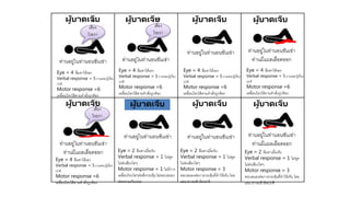ท่านอยู่ในท่านอนชันเข่า
ผู้บาดเจ็บ
ท่านอยู่ในท่านอนชันเข่า
ผู้บาดเจ็บ
ท่านอยู่ในท่านอนชันเข่า
ผู้บาดเจ็บ
ท่านอยู่ในท่านอนชันเข่า
ท่านมีแผลเลือดออก
ผู้บาดเจ็บ
ท่านอยู่ในท่านอนชันเข่า
ท่านมีแผลเลือดออก
ผู้บาดเจ็บ
ท่านอยู่ในท่านอนชันเข่า ท่านอยู่ในท่านอนชันเข่า
ผู้บาดเจ็บ
ท่านอยู่ในท่านอนชันเข่า
ท่านมีแผลเลือดออก
ผู้บาดเจ็บ
Eye = 4 ลืมตาได้เอง
Verbal response = 5 ถามตอบรู้เรื่อง
ปกติ
Motor response =6
เคลื่อนไหวได้ตามคาสั่งถูกต้อง
Eye = 4 ลืมตาได้เอง
Verbal response = 5 ถามตอบรู้เรื่อง
ปกติ
Motor response =6
เคลื่อนไหวได้ตามคาสั่งถูกต้อง
Eye = 4 ลืมตาได้เอง
Verbal response = 5 ถามตอบรู้เรื่อง
ปกติ
Motor response =6
เคลื่อนไหวได้ตามคาสั่งถูกต้อง
Eye = 4 ลืมตาได้เอง
Verbal response = 5 ถามตอบรู้เรื่อง
ปกติ
Motor response =6
เคลื่อนไหวได้ตามคาสั่งถูกต้อง
Eye = 2 ลืมตาเมื่อเจ็บ
Verbal response = 1 ไม่พูด
ไม่ส่งเสียงใดๆ
Motor response = 1 ไม่มีการ
เคลื่อนไหวใดๆต่อสิ่งกระตุ้นไม่ตอบสนอง
ต่อความเจ็บปวด
Eye = 2 ลืมตาเมื่อเจ็บ
Verbal response = 1 ไม่พูด
ไม่ส่งเสียงใดๆ
Motor response = 3
ตอบสนองต่อการกระตุ้นที่ทาให้เจ็บโดย
แขน ขางอเข้าผิดปกติ
Eye = 2 ลืมตาเมื่อเจ็บ
Verbal response = 1 ไม่พูด
ไม่ส่งเสียงใดๆ
Motor response = 3
ตอบสนองต่อการกระตุ้นที่ทาให้เจ็บโดย
แขน ขางอเข้าผิดปกติ
ส่ง
เสียง
โวยวา
ย
ส่ง
เสียง
โวยวา
ย
Eye = 4 ลืมตาได้เอง
Verbal response = 5 ถามตอบรู้เรื่อง
ปกติ
Motor response =6
เคลื่อนไหวได้ตามคาสั่งถูกต้อง
ส่ง
เสียง
โวยวา
ย
ผู้บาดเจ็บ
 