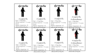ผู้บาดเจ็บ
ท่านอยู่ในท่ายืน
ผู้บาดเจ็บ
ท่านอยู่ในท่ายืน
ท่านมีแผลเลือดออก
ผู้บาดเจ็บ
ท่านอยู่ในท่ายืน
ผู้บาดเจ็บ
ท่านอยู่ในท่ายืน
ผู้บาดเจ็บ
ท่านอยู่ในท่ายืน
ผู้บาดเจ็บ
ท่านอยู่ในท่ายืน
ผู้บาดเจ็บ
ท่านอยู่ในท่ายืน
Eye = 4 ลืมตาได้เอง
Verbal response = 5 ถามตอบรู้
เรื่องปกติ
Motor response =6
เคลื่อนนไหวได้ตามคาสั่งถูกต้อง
Eye = 4 ลืมตาได้เอง
Verbal response = 5 ถามตอบรู้
เรื่องปกติ
Motor response =6
เคลื่อนนไหวได้ตามคาสั่งถูกต้อง
Eye = 4 ลืมตาได้เอง
Verbal response = 5 ถามตอบรู้
เรื่องปกติ
Motor response =6
เคลื่อนนไหวได้ตามคาสั่งถูกต้อง
Eye = 4 ลืมตาได้เอง
Verbal response = 5 ถามตอบรู้
เรื่องปกติ
Motor response =6
เคลื่อนไหวได้ตามคาสั่งถูกต้อง
ผู้บาดเจ็บ
ท่านอยู่ในท่ายืน
ท่านมีแผลเลือดออก
Eye = 4 ลืมตาได้เอง
Verbal response = 5 ถามตอบรู้
เรื่องปกติ
Motor response =6
เคลื่อนไหวได้ตามคาสั่งถูกต้อง
Eye = 4 ลืมตาได้เอง
Verbal response = 5 ถามตอบรู้
เรื่องปกติ
Motor response =6
เคลื่อนนไหวได้ตามคาสั่งถูกต้อง
Eye = 4 ลืมตาได้เอง
Verbal response = 5 ถามตอบรู้
เรื่องปกติ
Motor response =6
เคลื่อนนไหวได้ตามคาสั่งถูกต้อง
Eye = 4 ลืมตาได้เอง
Verbal response = 5 ถามตอบรู้
เรื่องปกติ
Motor response =6
เคลื่อนนไหวได้ตามคาสั่งถูกต้อง
 