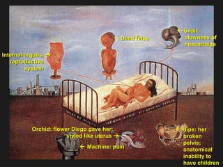 Snail:  slowness of miscarraige Hips: her broken pelvis;  anatomical inability to have children  Dead fetus Internal organs,   reproductive  system  Orchid: flower Diego gave her;  styled like uterus      Machine: pain  