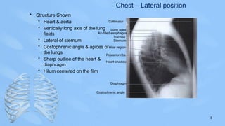 Comprehensive Radiographic Anatomy of the Chest and Heart Structures | PPSX