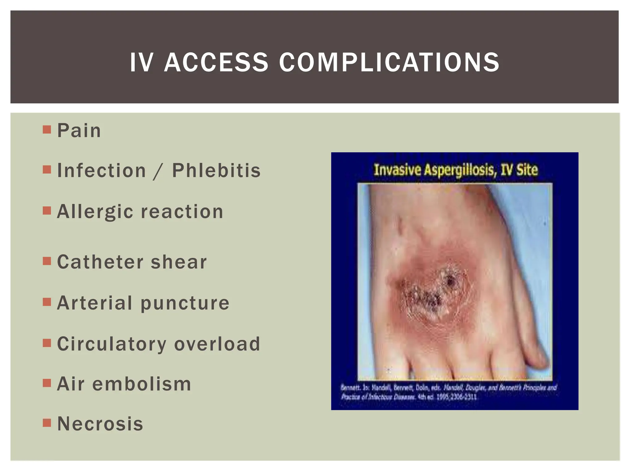 Iv Reactions Intravenous Fluids and Drug Calculations | PPT