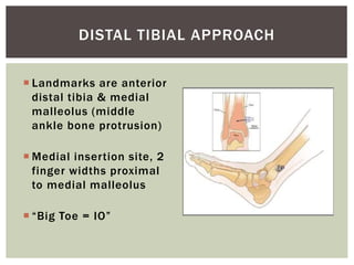 Intravenous Fluids and Drug Calculations | PPT