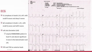 Weekly case -Device therapy in HF.pptx file | PPTX