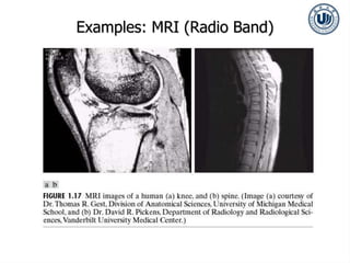 Examples: MRI (Radio Band)
 
