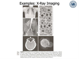 Examples: X-Ray Imaging
 