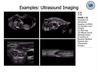 Examples: Ultrasound Imaging
 
