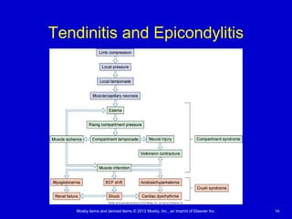 Mosby items and derived items © 2012 Mosby, Inc., an imprint of Elsevier Inc. 14
Tendinitis and Epicondylitis
 