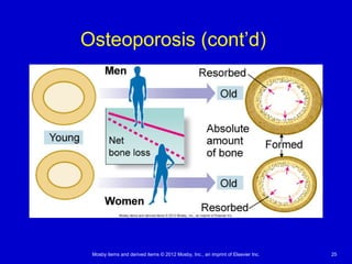Mosby items and derived items © 2012 Mosby, Inc., an imprint of Elsevier Inc. 25
Osteoporosis (cont’d)
 