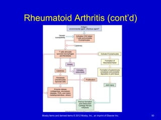 Mosby items and derived items © 2012 Mosby, Inc., an imprint of Elsevier Inc. 50
Rheumatoid Arthritis (cont’d)
 