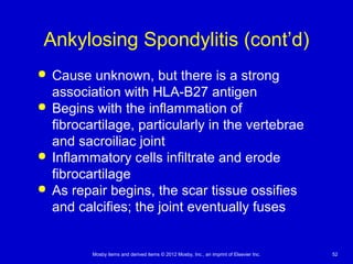 Mosby items and derived items © 2012 Mosby, Inc., an imprint of Elsevier Inc. 52
Ankylosing Spondylitis (cont’d)
 Cause unknown, but there is a strong
association with HLA-B27 antigen
 Begins with the inflammation of
fibrocartilage, particularly in the vertebrae
and sacroiliac joint
 Inflammatory cells infiltrate and erode
fibrocartilage
 As repair begins, the scar tissue ossifies
and calcifies; the joint eventually fuses
 