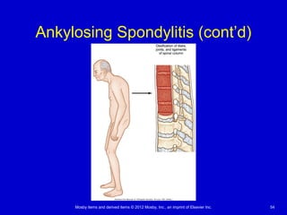 Mosby items and derived items © 2012 Mosby, Inc., an imprint of Elsevier Inc. 54
Ankylosing Spondylitis (cont’d)
 