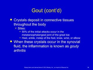 Mosby items and derived items © 2012 Mosby, Inc., an imprint of Elsevier Inc. 56
Gout (cont’d)
 Crystals deposit in connective tissues
throughout the body
 Sites:
• 50% of the initial attacks occur in the
metatarsophalangeal joint of the great toe
• Heel, ankle, instep of the foot, knee, wrist, or elbow
 When these crystals occur in the synovial
fluid, the inflammation is known as gouty
arthritis
 