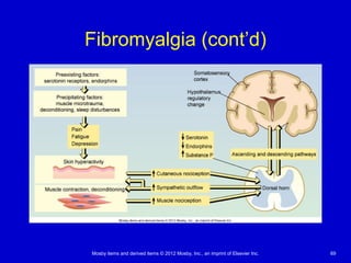 Mosby items and derived items © 2012 Mosby, Inc., an imprint of Elsevier Inc. 69
Fibromyalgia (cont’d)
 