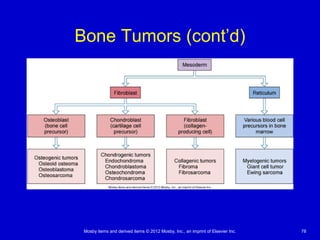 Mosby items and derived items © 2012 Mosby, Inc., an imprint of Elsevier Inc. 78
Bone Tumors (cont’d)
 