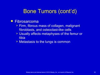 Mosby items and derived items © 2012 Mosby, Inc., an imprint of Elsevier Inc. 83
Bone Tumors (cont’d)
 Fibrosarcoma
 Firm, fibrous mass of collagen, malignant
fibroblasts, and osteoclast-like cells
 Usually affects metaphyses of the femur or
tibia
 Metastasis to the lungs is common
 