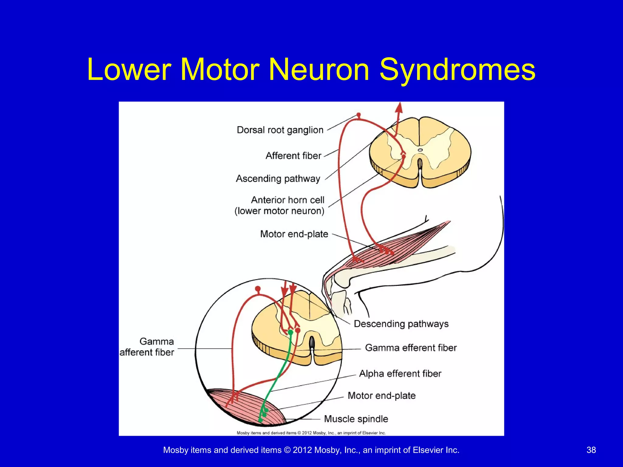 Mosby items and derived items © 2012 Mosby, Inc., an imprint of Elsevier Inc. 3838
Lower Motor Neuron Syndromes
 