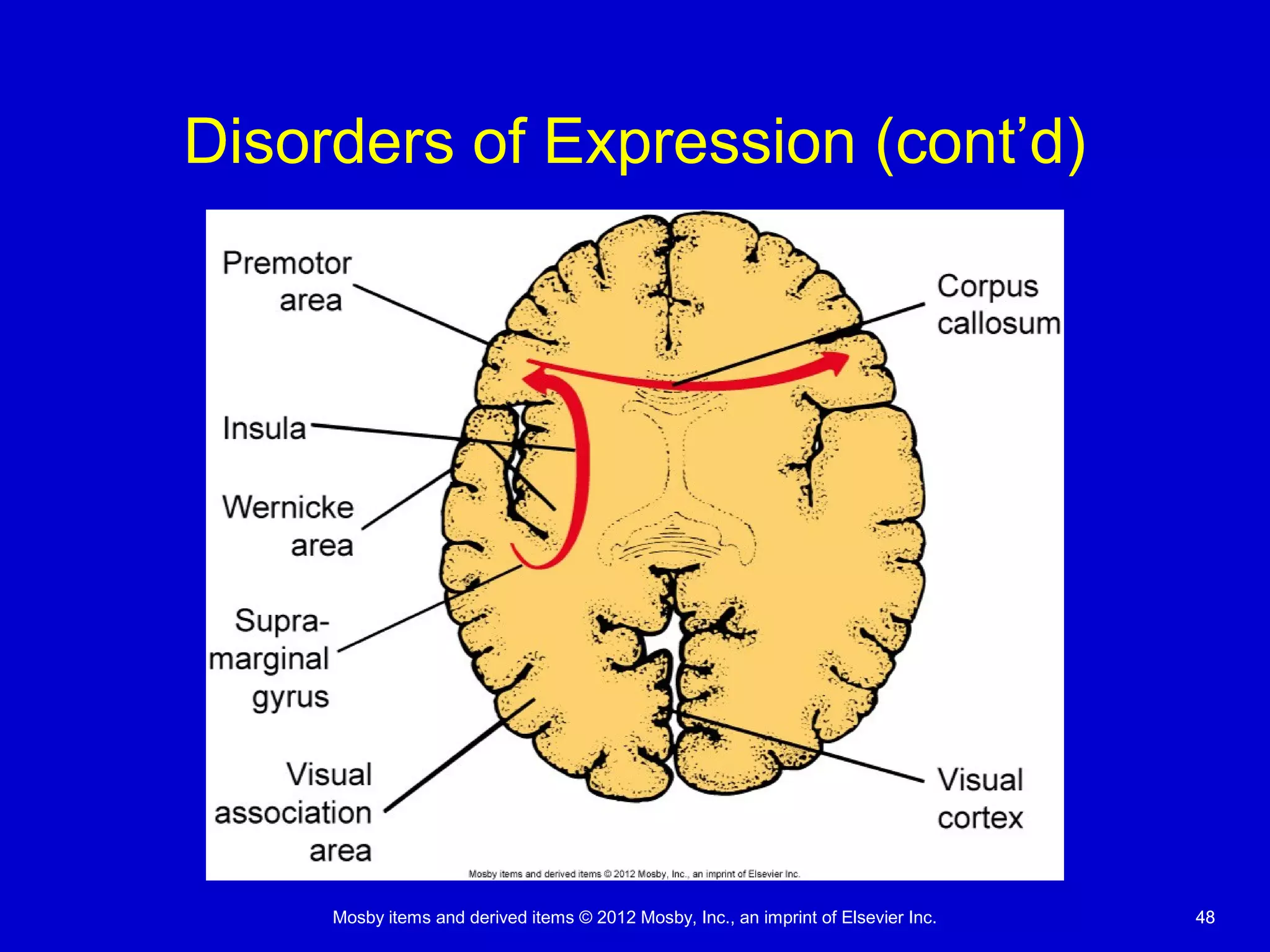 Mosby items and derived items © 2012 Mosby, Inc., an imprint of Elsevier Inc. 4848
Disorders of Expression (cont’d)
 
