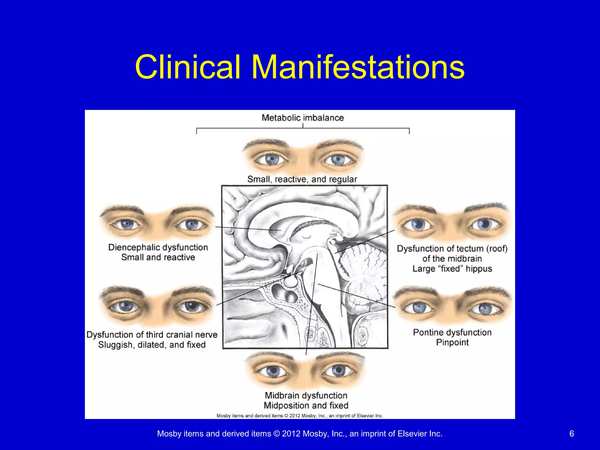 Mosby items and derived items © 2012 Mosby, Inc., an imprint of Elsevier Inc. 66
Clinical Manifestations
 