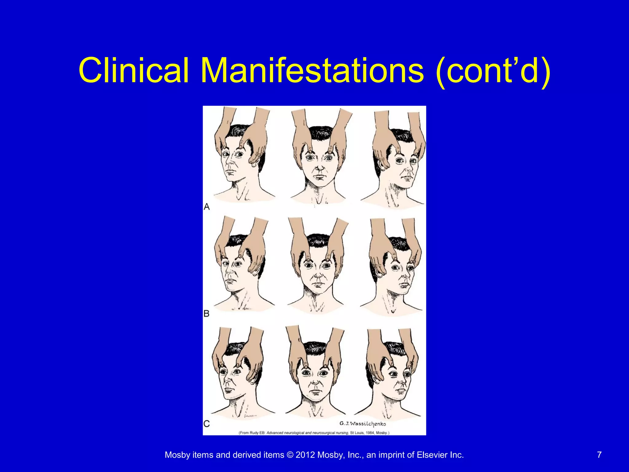 Mosby items and derived items © 2012 Mosby, Inc., an imprint of Elsevier Inc. 77
Clinical Manifestations (cont’d)
 