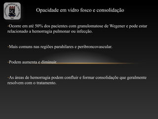 Opacidade em vidro fosco e consolidação

-Ocorre em até 50% dos pacientes com granulomatose de Wegener e pode estar
relacionado a hemorragia pulmonar ou infecção.


-Mais comuns nas regiões parahilares e peribroncovascular.


-Podem aumenta e diminuir.


-As áreas de hemorragia podem confluir e formar consolidaçõe que geralmente
resolvem com o tratamento.
 