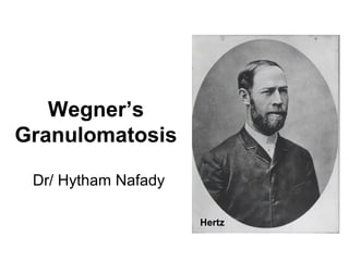 Wegner’s
Granulomatosis
Dr/ Hytham Nafady
Hertz
 