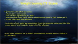 Weight bearing CT Scans
• (FAO) Foot Ankle Offset( four points) :
– software-based measurement
– semi-automatic algorithm ...