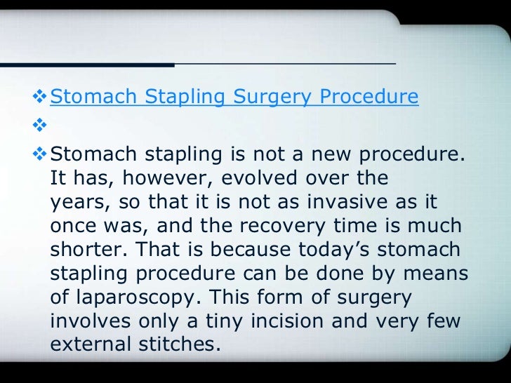 Weight loss surgical options include stomach stapling and duodenal switch