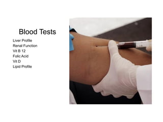 Blood Tests
Liver Profile
Renal Function
Vit B 12
Folic Acid
Vit D
Lipid Profile
 