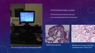 PHOTOGRAPHING SLIDES
Of Decellurised and Recellurised lung
and assembling PowerPoints of the slides
Recellurised mouse lung slide
ventilated with 150ml of airThe microscope used to photograph slides
Native pig lung slide
 