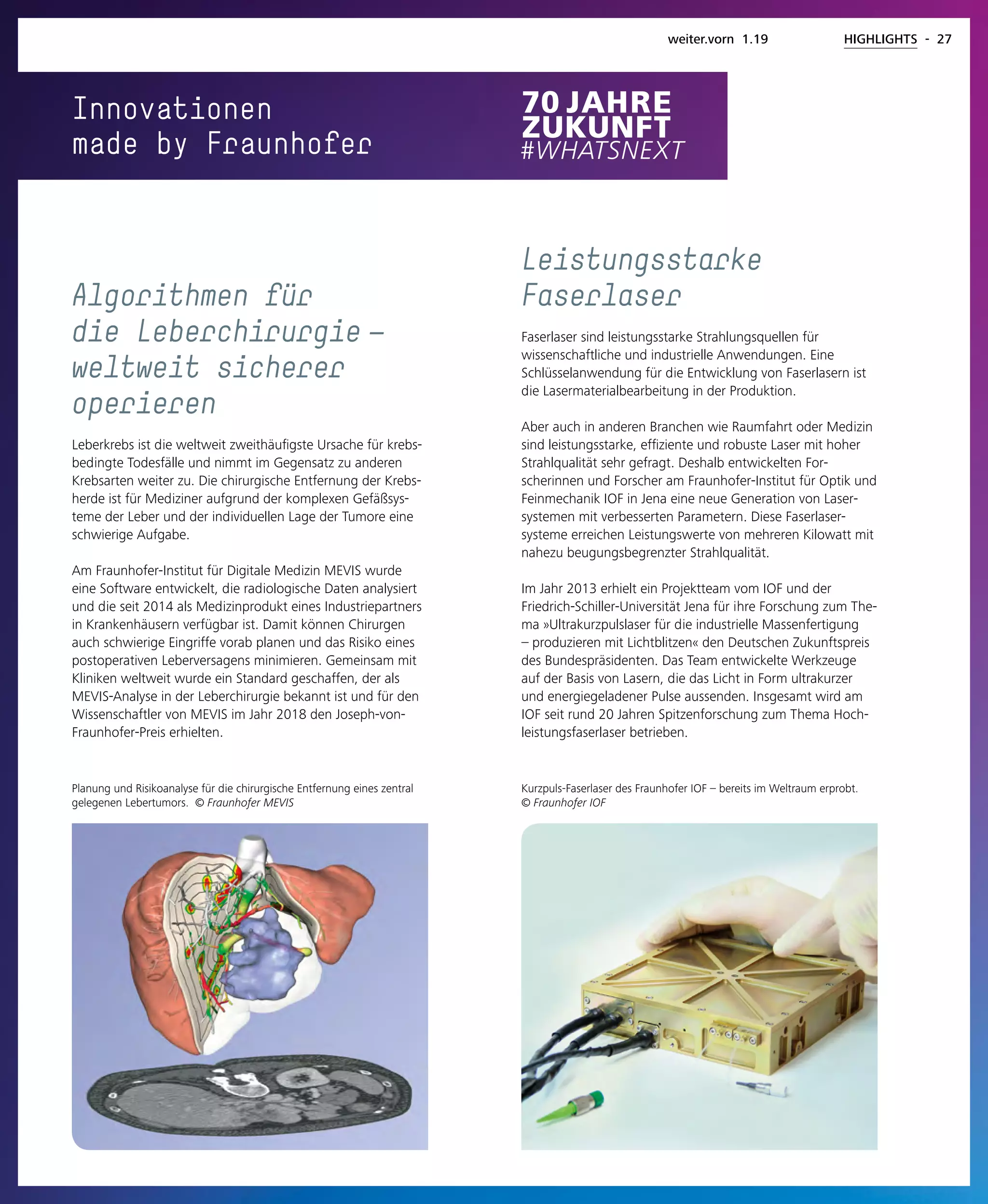 Innovationen
made by Fraunhofer
Planung und Risikoanalyse für die chirurgische Entfernung eines zentral
gelegenen Lebertumors. © Fraunhofer MEVIS
Algorithmen für
die Leberchirurgie — 
weltweit sicherer
operieren
Leberkrebs ist die weltweit zweithäufigste Ursache für krebs-
bedingte Todesfälle und nimmt im Gegensatz zu anderen
Krebsarten weiter zu. Die chirurgische Entfernung der Krebs-
herde ist für Mediziner aufgrund der komplexen Gefäßsys-
teme der Leber und der individuellen Lage der Tumore eine
schwierige Aufgabe.
Am Fraunhofer-Institut für Digitale Medizin MEVIS wurde
eine Software entwickelt, die radiologische Daten analysiert
und die seit 2014 als Medizinprodukt eines Industriepartners
in Krankenhäusern verfügbar ist. Damit können Chirurgen
auch schwierige Eingriffe vorab planen und das Risiko eines
postoperativen Leberversagens minimieren. Gemeinsam mit
Kliniken weltweit wurde ein Standard geschaffen, der als
MEVIS-Analyse in der Leberchirurgie bekannt ist und für den
Wissenschaftler von MEVIS im Jahr 2018 den Joseph-von-
Fraunhofer-Preis erhielten.
Kurzpuls-Faserlaser des Fraunhofer IOF – bereits im Weltraum erprobt.
© Fraunhofer IOF
Leistungsstarke
Faserlaser
Faserlaser sind leistungsstarke Strahlungsquellen für
wissenschaftliche und industrielle Anwendungen. Eine
Schlüsselanwendung für die Entwicklung von Faserlasern ist
die Lasermaterialbearbeitung in der Produktion.
Aber auch in anderen Branchen wie Raumfahrt oder Medizin
sind leistungsstarke, effiziente und robuste Laser mit hoher
Strahlqualität sehr gefragt. Deshalb entwickelten For-
scherinnen und Forscher am Fraunhofer-Institut für Optik und
Feinmechanik IOF in Jena eine neue Generation von Laser-
systemen mit verbesserten Parametern. Diese Faserlaser-
systeme erreichen Leistungswerte von mehreren Kilowatt mit
nahezu beugungsbegrenzter Strahlqualität.
Im Jahr 2013 erhielt ein Projektteam vom IOF und der
Friedrich-Schiller-Universität Jena für ihre Forschung zum The-
ma »Ultrakurzpulslaser für die industrielle Massenfertigung
– produzieren mit Lichtblitzen« den Deutschen Zukunftspreis
des Bundespräsidenten. Das Team entwickelte Werkzeuge
auf der Basis von Lasern, die das Licht in Form ultrakurzer
und energiegeladener Pulse aussenden. Insgesamt wird am
IOF seit rund 20 Jahren Spitzenforschung zum Thema Hoch-
leistungsfaserlaser betrieben.
weiter.vorn 1.19 HIGHLIGHTS - 27
 