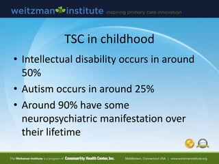TSC in childhood
• Intellectual disability occurs in around
50%
• Autism occurs in around 25%
• Around 90% have some
neuropsychiatric manifestation over
their lifetime
 