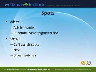 Spots
• White
– Ash leaf spots
– Punctate loss of pigmentation
• Brown
– Café au lait spots
– Nevi
– Brown patches
 