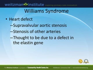 Williams Syndrome
• Facial features
– Periorbital puffiness
– Wide mouth & thick lips
– Stellate irides
 