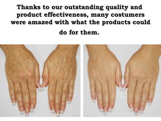 Thanks to our outstanding quality andThanks to our outstanding quality and
product effectiveness, many costumersproduct effectiveness, many costumers
were amazed with what the products couldwere amazed with what the products could
do for them.do for them.
 