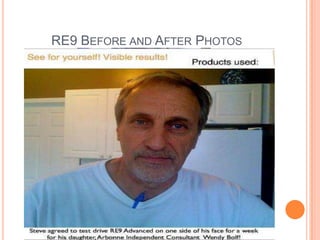 RE9 BEFORE AND AFTER PHOTOS
 
