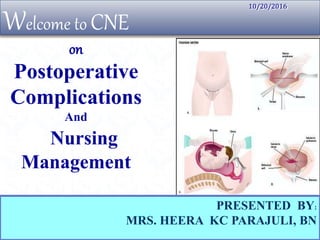 Welcome to CNE
PRESENTED BY:
MRS. HEERA KC PARAJULI, BN
10/20/2016
on
Postoperative
Complications
And
Nursing
Management
 