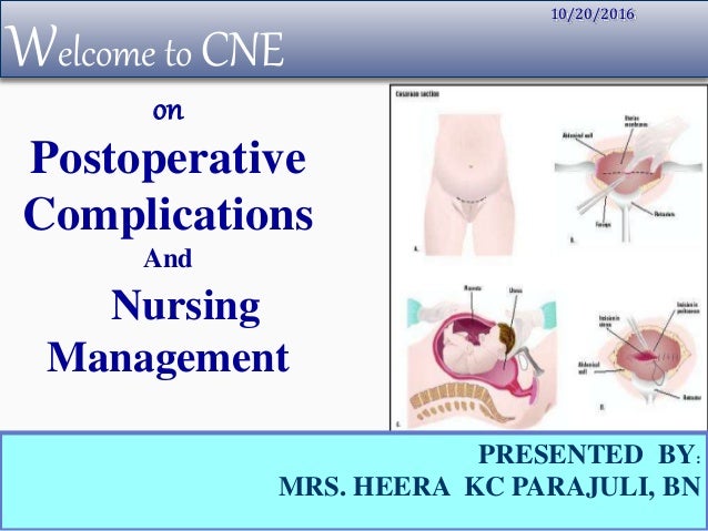 Welcome to CNE
PRESENTED BY:
MRS. HEERA KC PARAJULI, BN
10/20/2016
on
Postoperative
Complications
And
Nursing
Management
 
